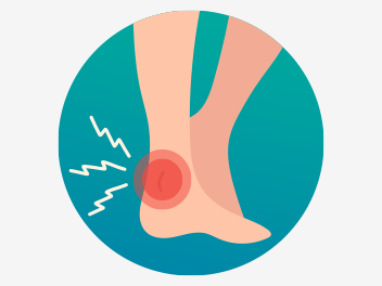 Achilles Tendonitis