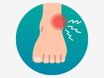 Ankle Sprains