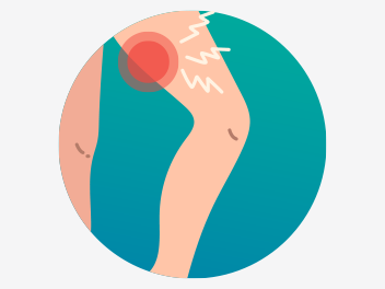 Hamstring Strain