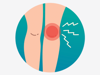 Runner's Knee