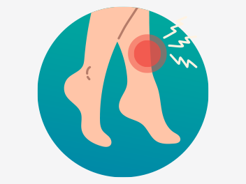 Shin Splints