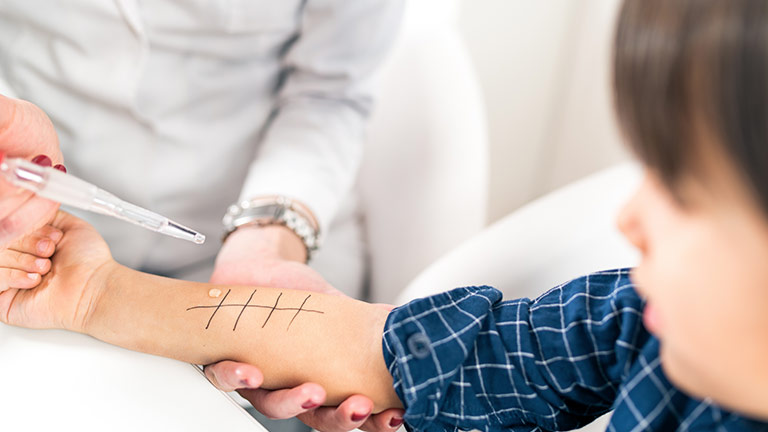 A young child getting drops of potential allergens on their arm during a skin test