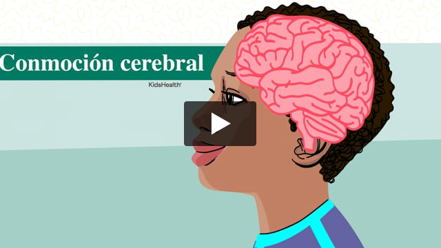 Conmoción cerebral