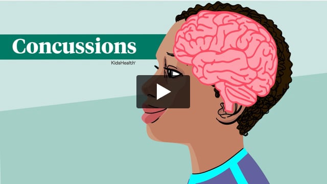 Concussions