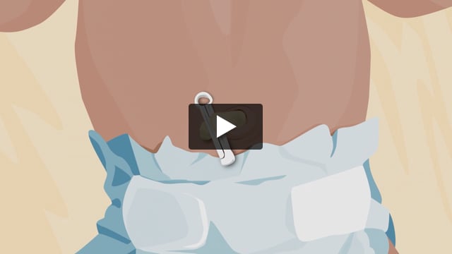 How to Care for Your Newborn's Umbilical Cord
