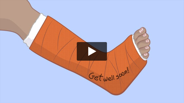 Taking Care of a Cast