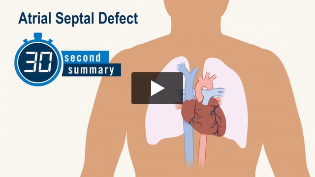 30-Second Summary: Atrial Septal Defect