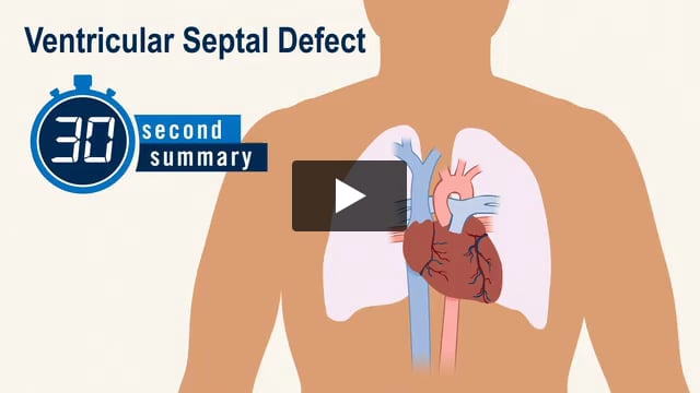30-Second Summary: Ventricular Septal Defect