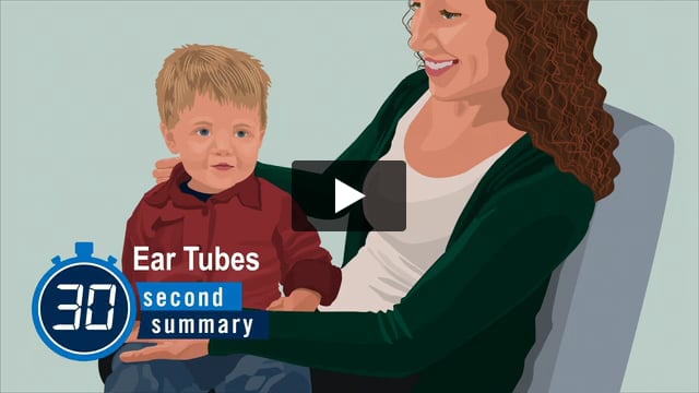 30-Second Summary: Ear Tube Surgery