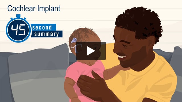 45-Second Summary: Cochlear Implant