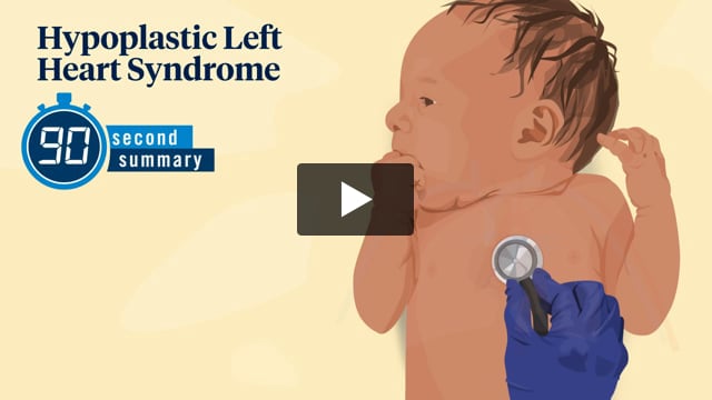 90 Second Summary: Hypoplastic Left Heart Syndrome