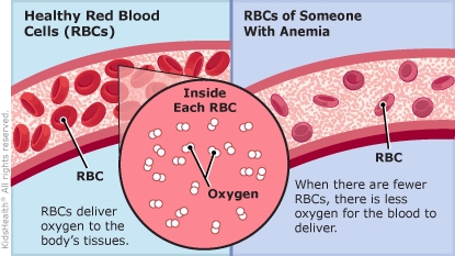 Illustration comparing a vein with healthy red blood cells to a vein of someone with anemia