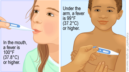 fever (high temperature) in kids