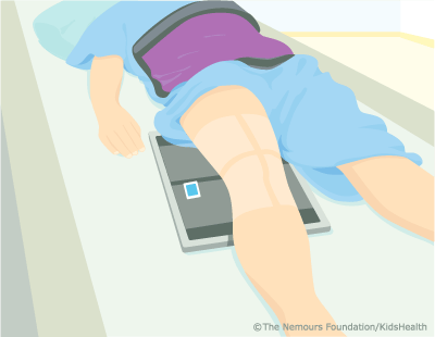 knee xray illustration