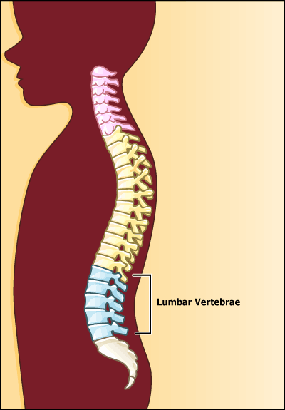 Magentic resonance imaging lumbar spine