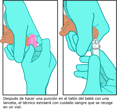 heelPrick_400x380_esIL.jpg