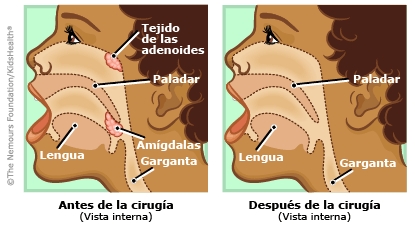 ilustracion