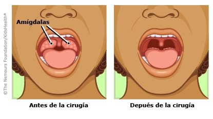 ilustracion